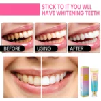Clinical B3 Stain Eraser Toothpaste | [Pre-Retail Tester Offer] Painless Whitening - Image 2